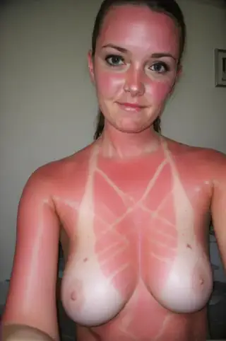 Sunburned (Big Lust)